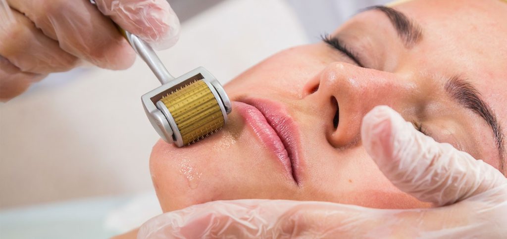 Microagulhamento (facial e corporal)